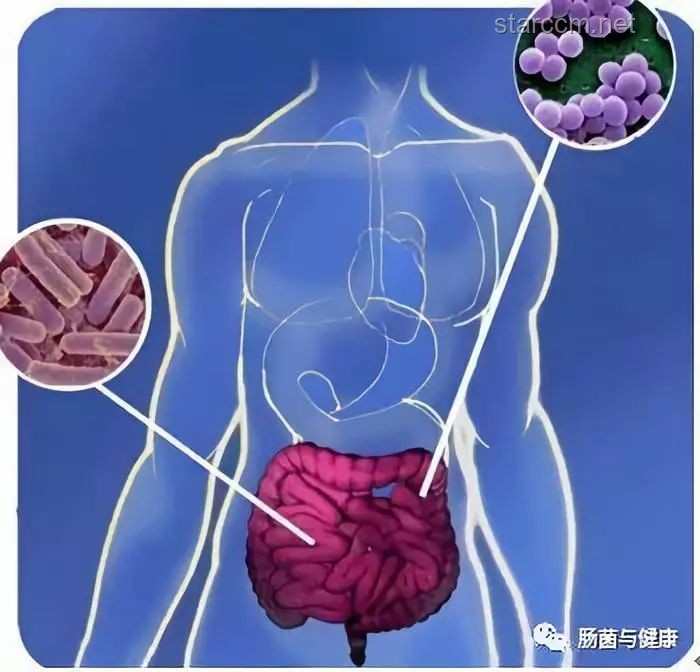 肠道失衡：便秘的隐形“幕后黑手”，如何重拾肠道健康？